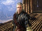 V�deo The Witcher 2: Gameplay: Asedio